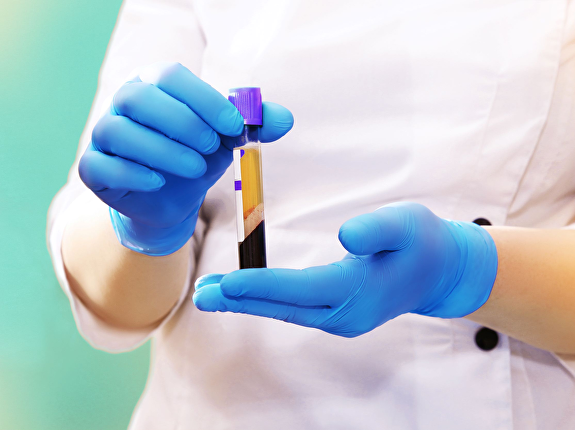 Voordelen combineren FUE en haarverbetering (PlaatjesRijk Plasma)